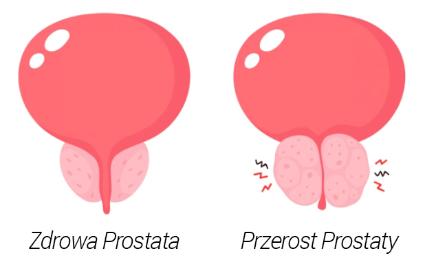 Prostazolin